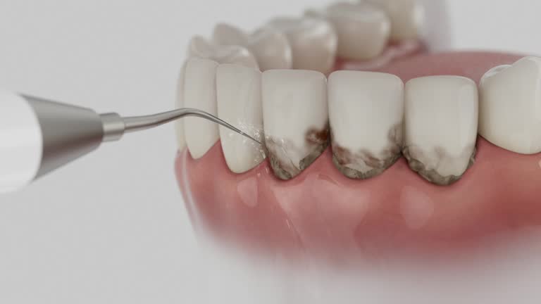 Reliable Dental contractor in Ann Arbor, MI by Dentist Open Now